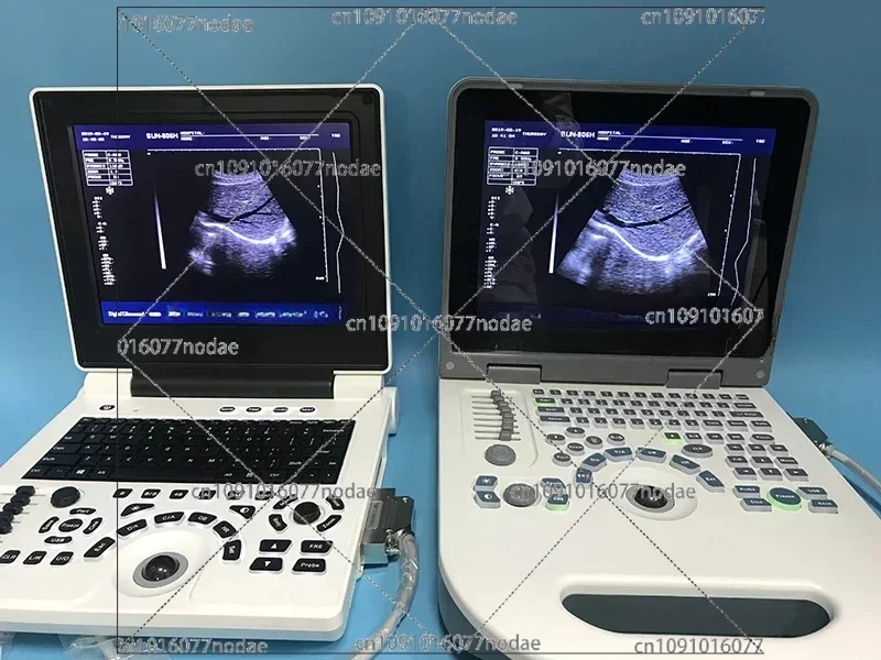 Дешевый ноутбук Ecograph черно-белый ультразвуковой апарат дешевый чем 2D-аппарат Logiq