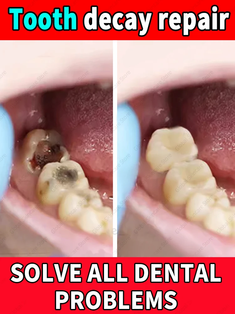 Ремонт зубов Касай