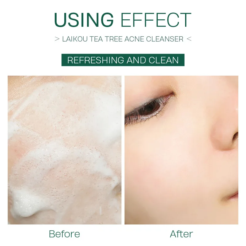 LAIKOU чайное дерево очищающее средство для лица мужчин и женщин против акне