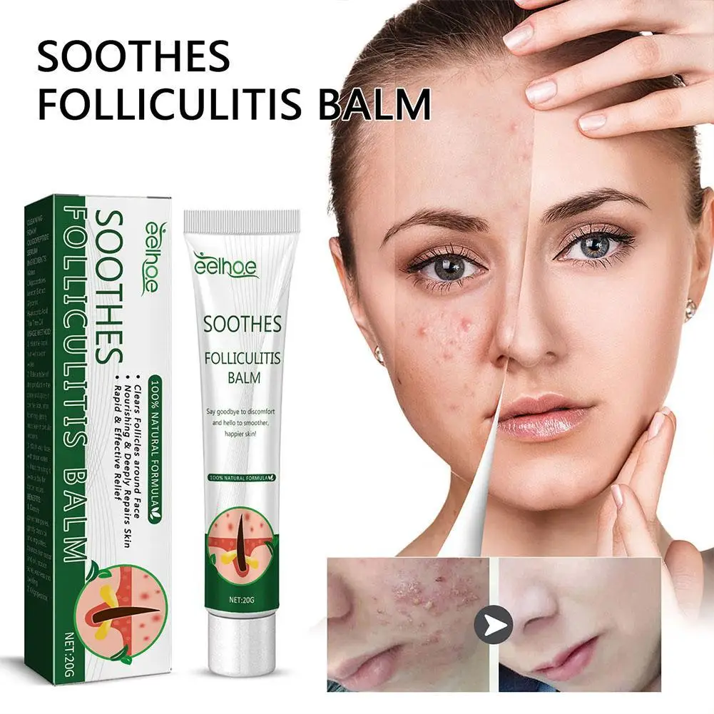 

Acne Treatment Cream Relief Redness Folliculitis Erythema Itching Shrink Pore Moisturizing Folliculitis Soothing Cream Skin Care