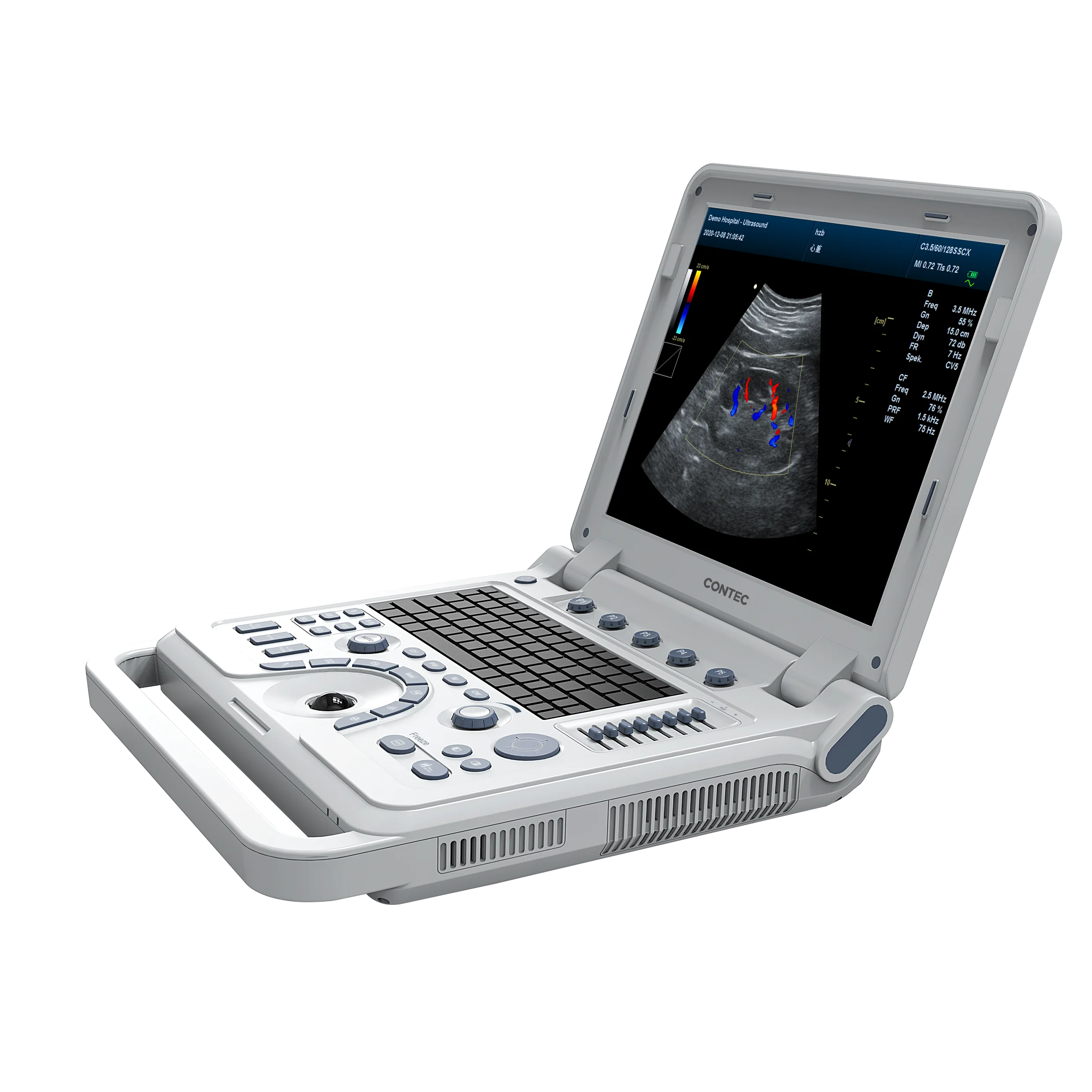 Рисунок 2 - Цветной Допплер CONTEC CMS1700B
