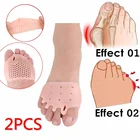 2 шт., ортодонтический выпрямитель для пальцев стоп