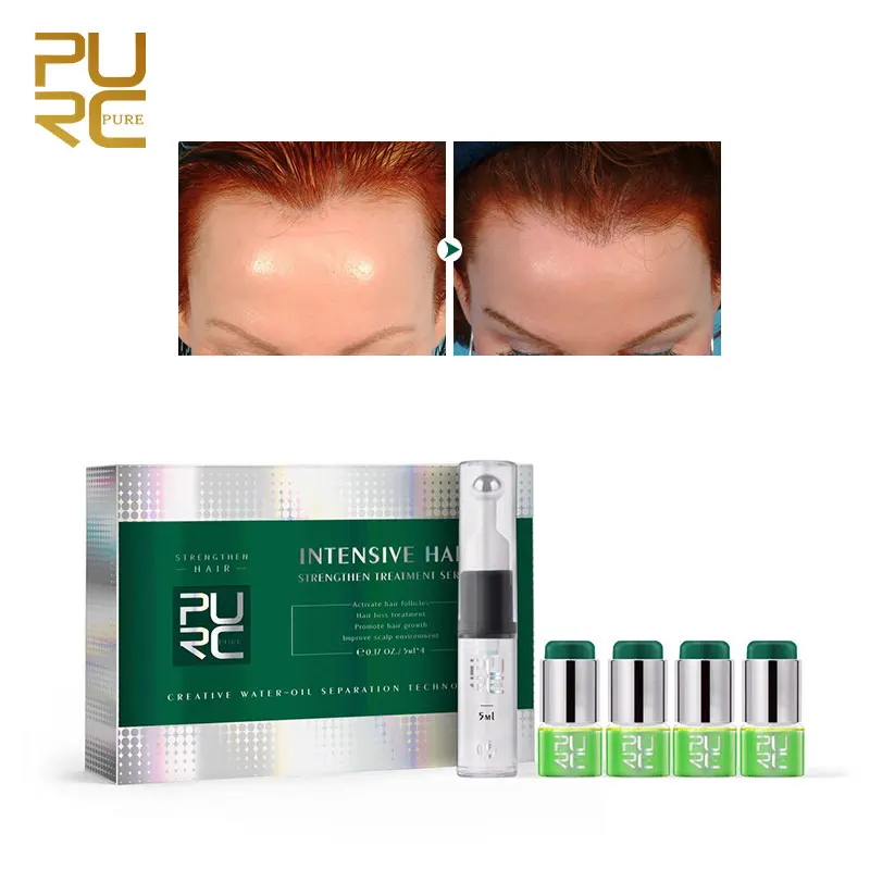 Продукты для роста волос PURC Имбирная эссенция натуральное растительное масло