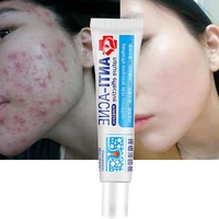 herbal acne treatment acne scar removal cream brighten dark spots acne marks shrink pores oil control whitening facial skin care