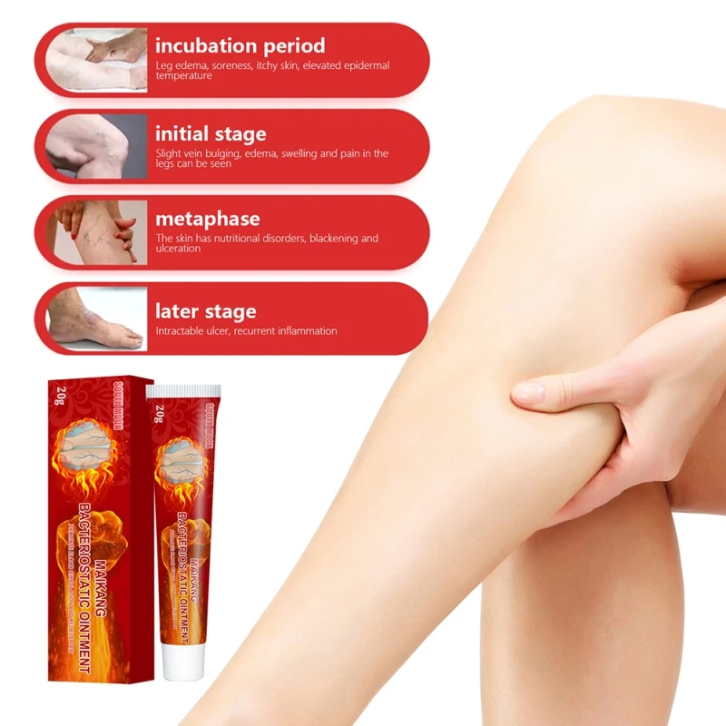 Крем для тела от варикозного расширения вен ног колен подтягивает кожу снимает