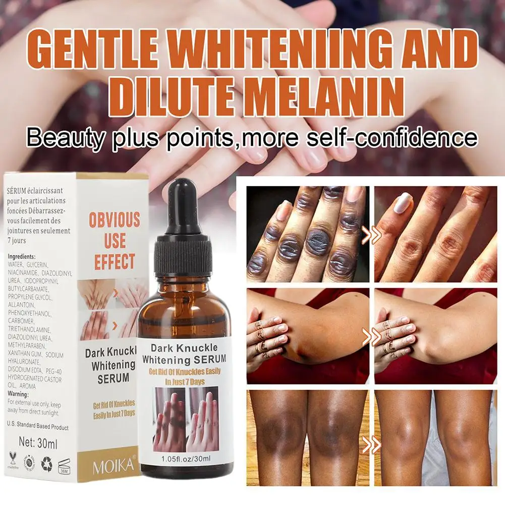 

30ml Whitening Moisturizing Serum Hand Knuckle Glow Serum for Removing Dark Knuckle Elbow Knee Strong Dark Knuckle Serum Un A3D0