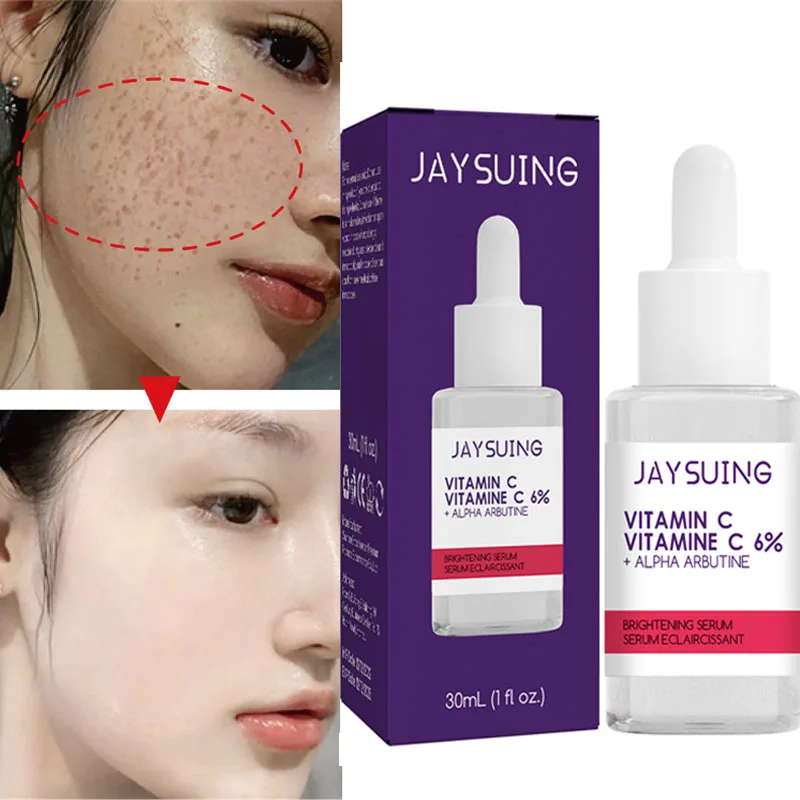 

Effective Freckle Whitening Serum Fade Dark Spots Removal Melanin Improve Dull Essence Brighten Moisturizing Beauty Facial Care