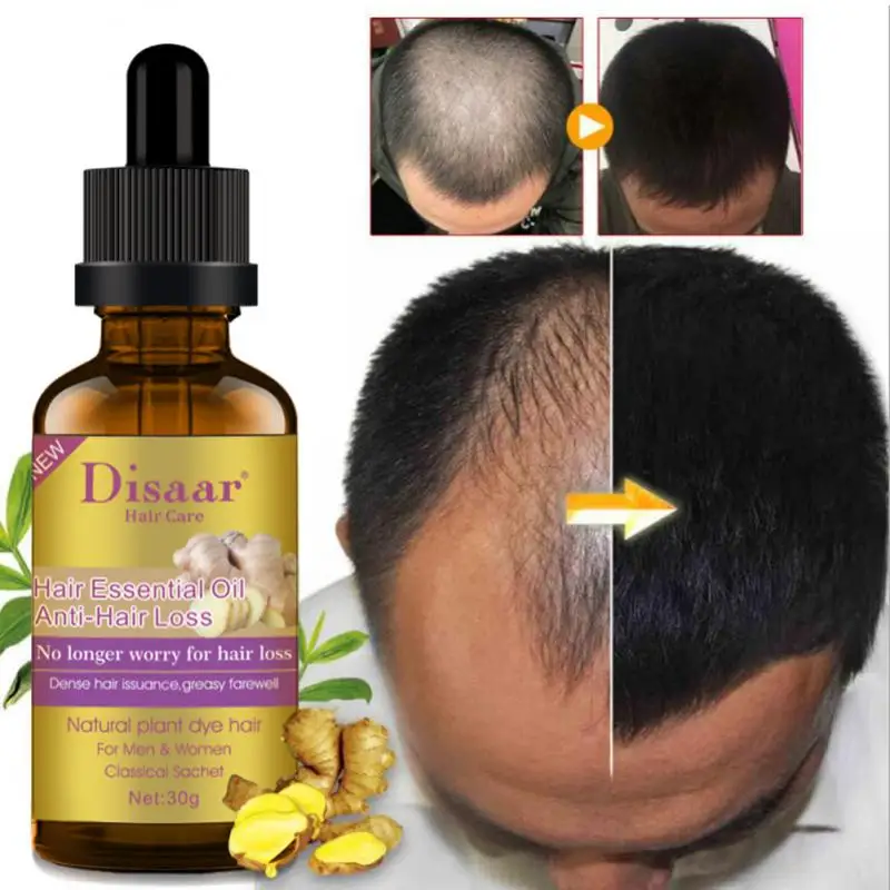 

Disaar 30ml Hair Loss Treatment Fast Hair Regrowth Essential Oil 7 Days Anti-loss Strong The Root Of Hair Serum TSLM1