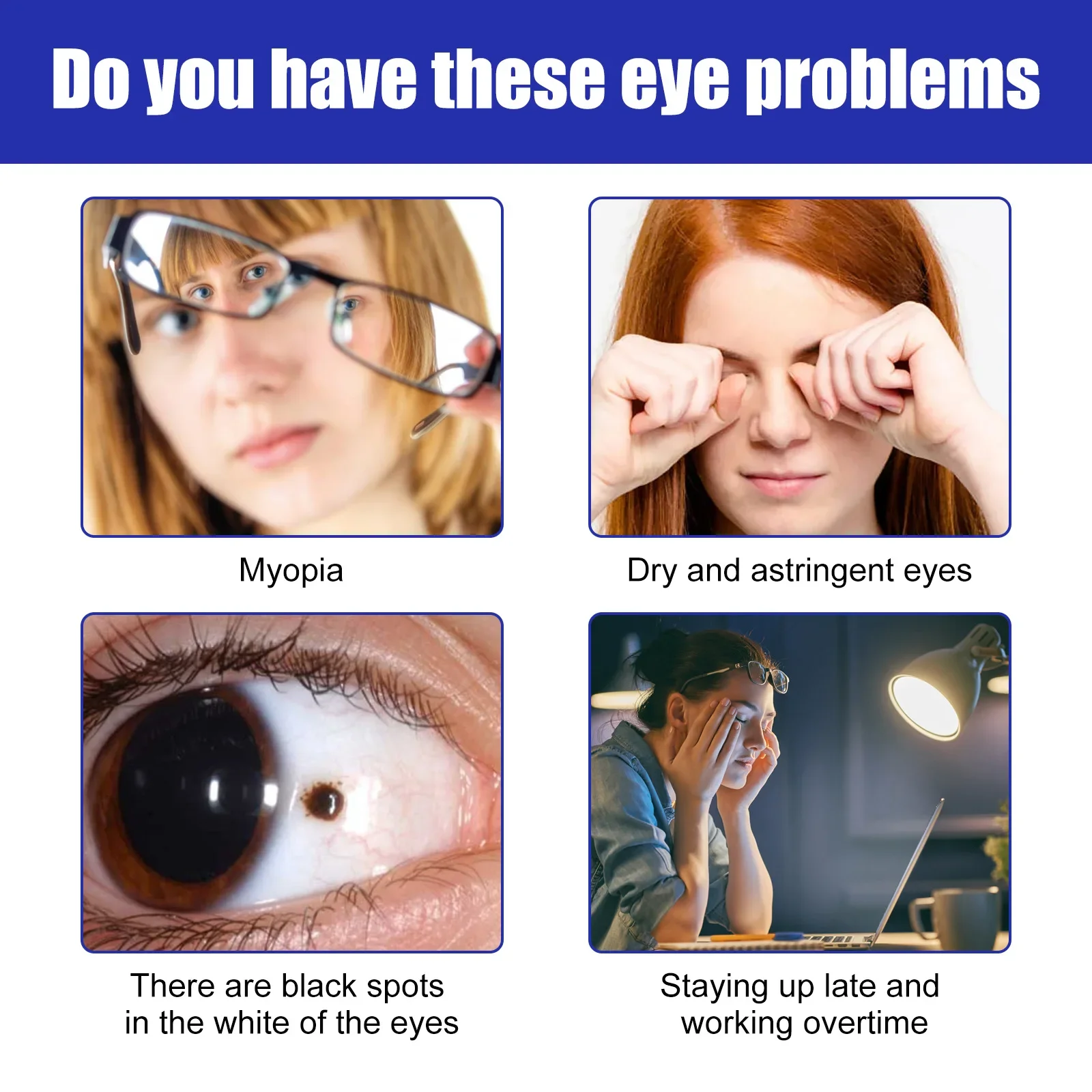 Роликовая Сыворотка Для Улучшения Глаз 15 Мл Против Отечности Уменьшения Темных