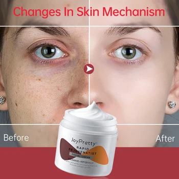 New Whitening Cream Skin Care Emulsifiers Niacinamide Peptide Anti-ageing Face Wrinkl Cream Dark Spot Remove Beauty Health 4