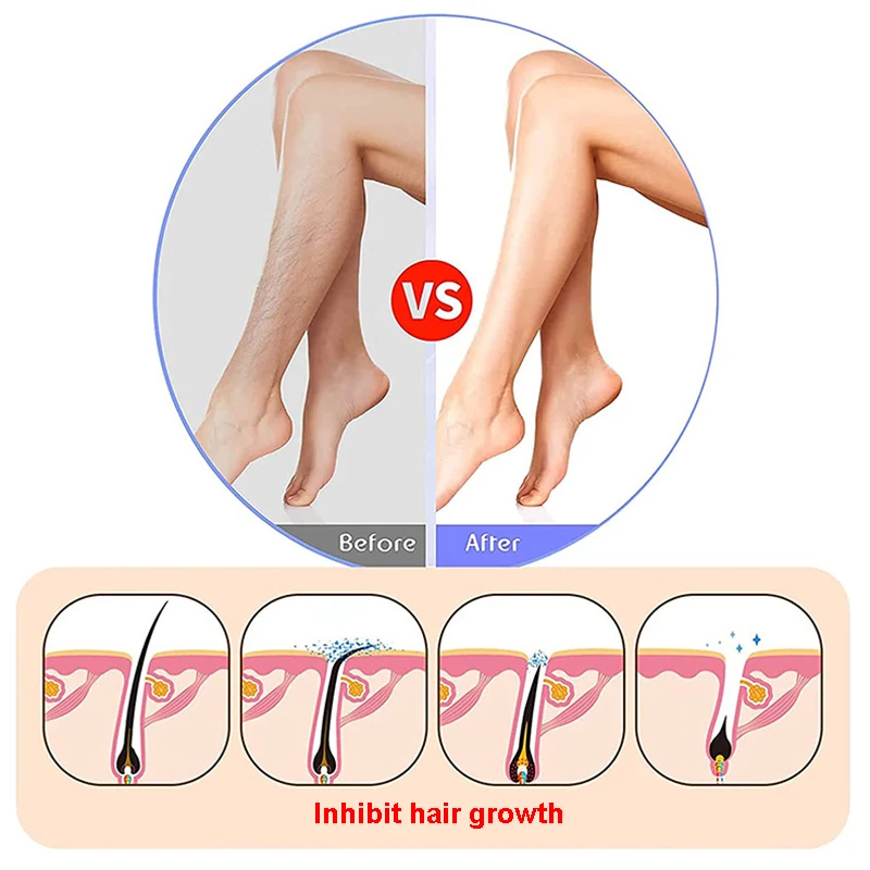 Рисунок 3 - Прозрачный ластик для волос