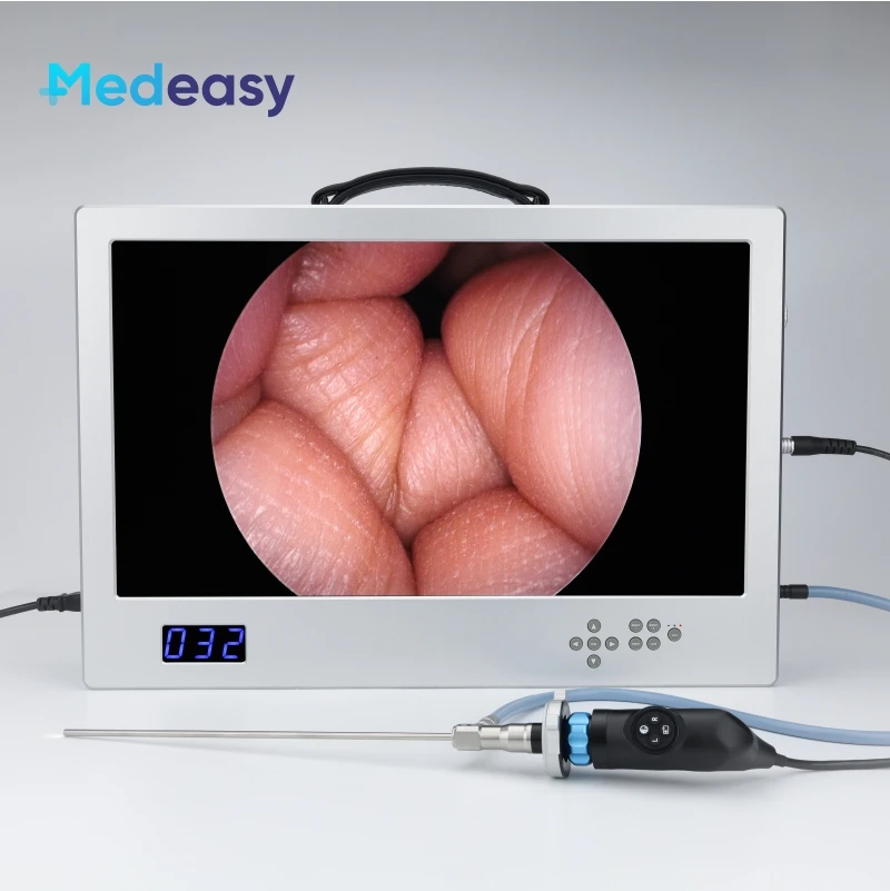 

Medical endoscope camera system Full HD with 24 inch monitor, 80W LED light source and HD recorder