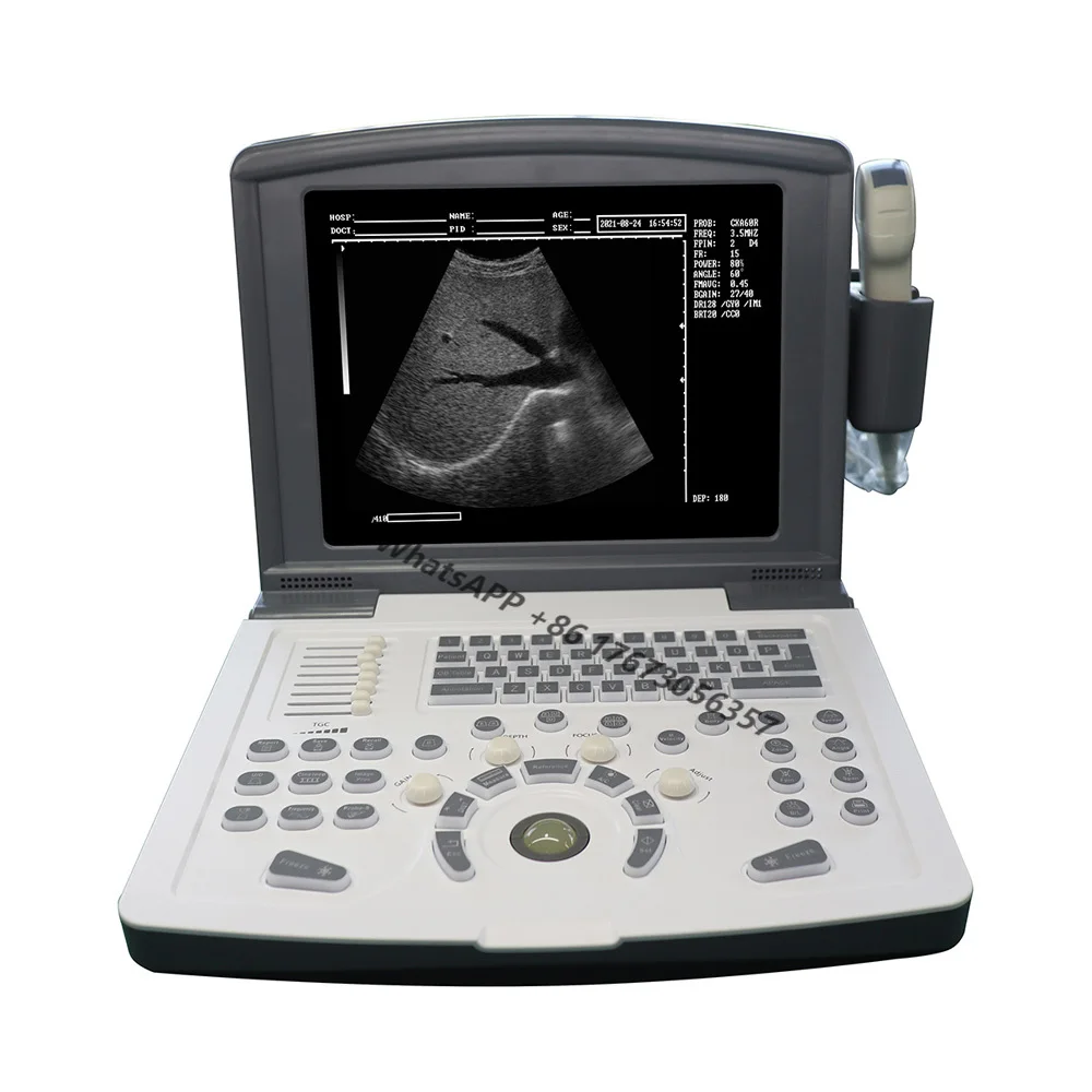 

RH-300A portable ultrasonic system cheap price B ultrasound machine