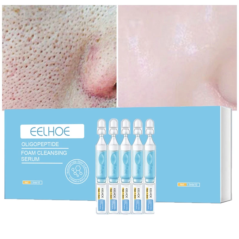 10pcs Oligopeptide Small Bubble Cleansing Essence Pore Shrink Oil Control Remove Acne Blackheads Brighten Moisturizing Skin Care