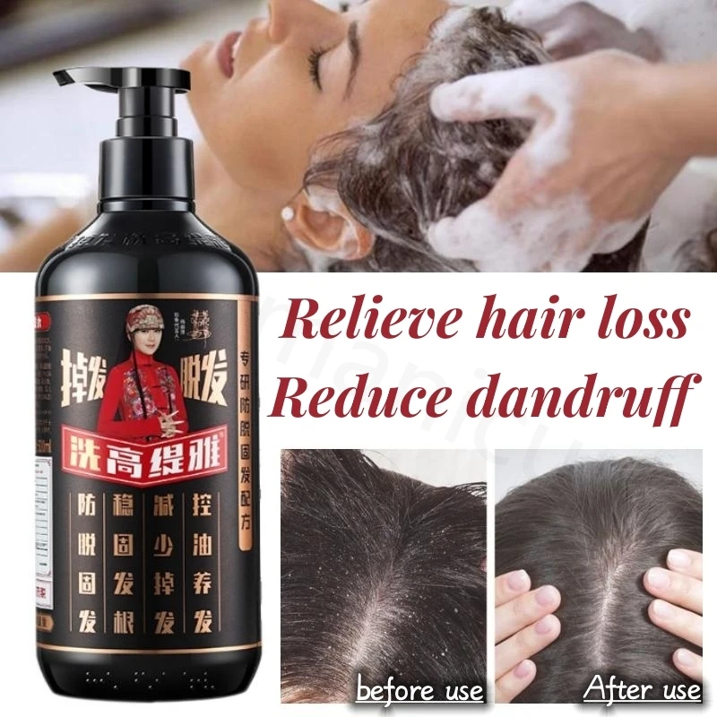 

Ginger Anti-hair Loss Shampoo Oil Control Dandruff Anti-dandruff Solid Hair Anti-itch Smooth Shampoo Amino Acid Conditioner