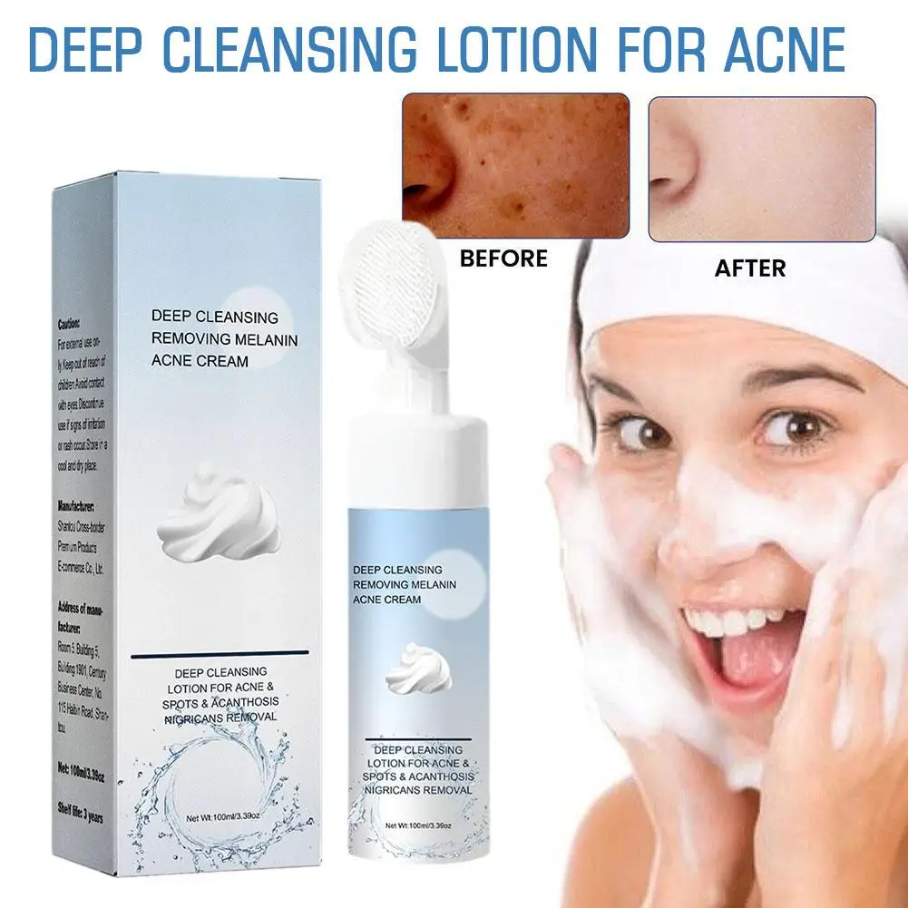 

Acne Cleansing Foam Moisturizing Anti Acne Cleanser Smooth Face Oil Whitening Blackhead Control Pimple Removal Spots Wash F R5S5