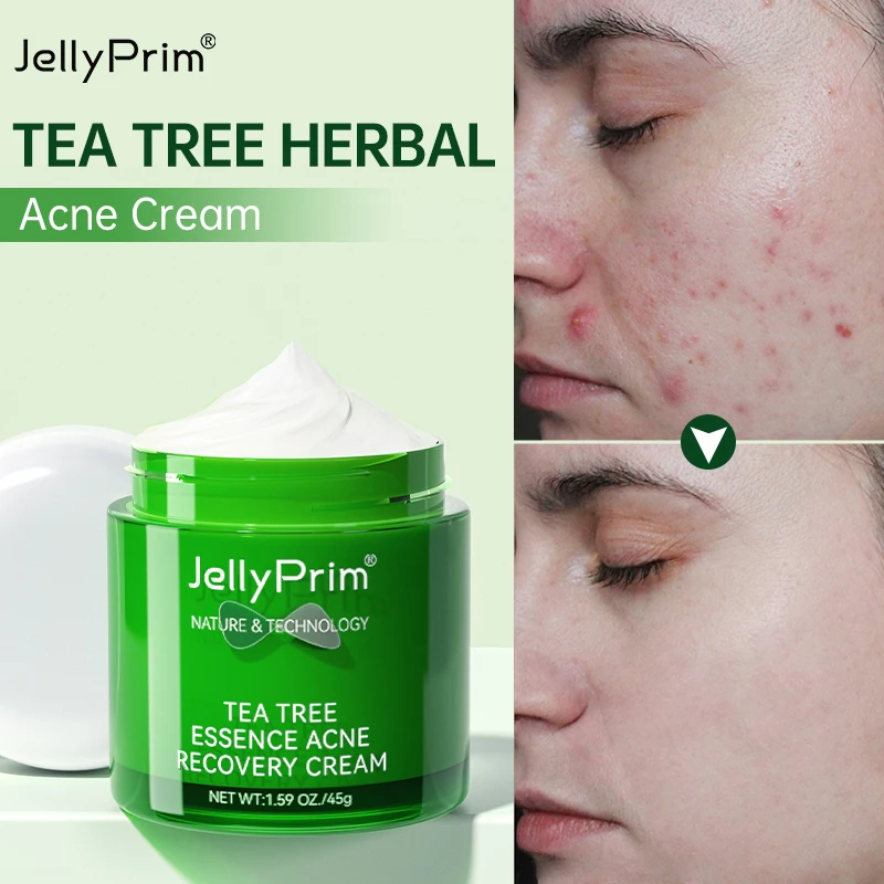 

2023 Acne Face Cream Tea Tree Acne Remover Treatment Skin Care Oil Control Facial Moisturizing Creams Pimple Mark Whitening 45g