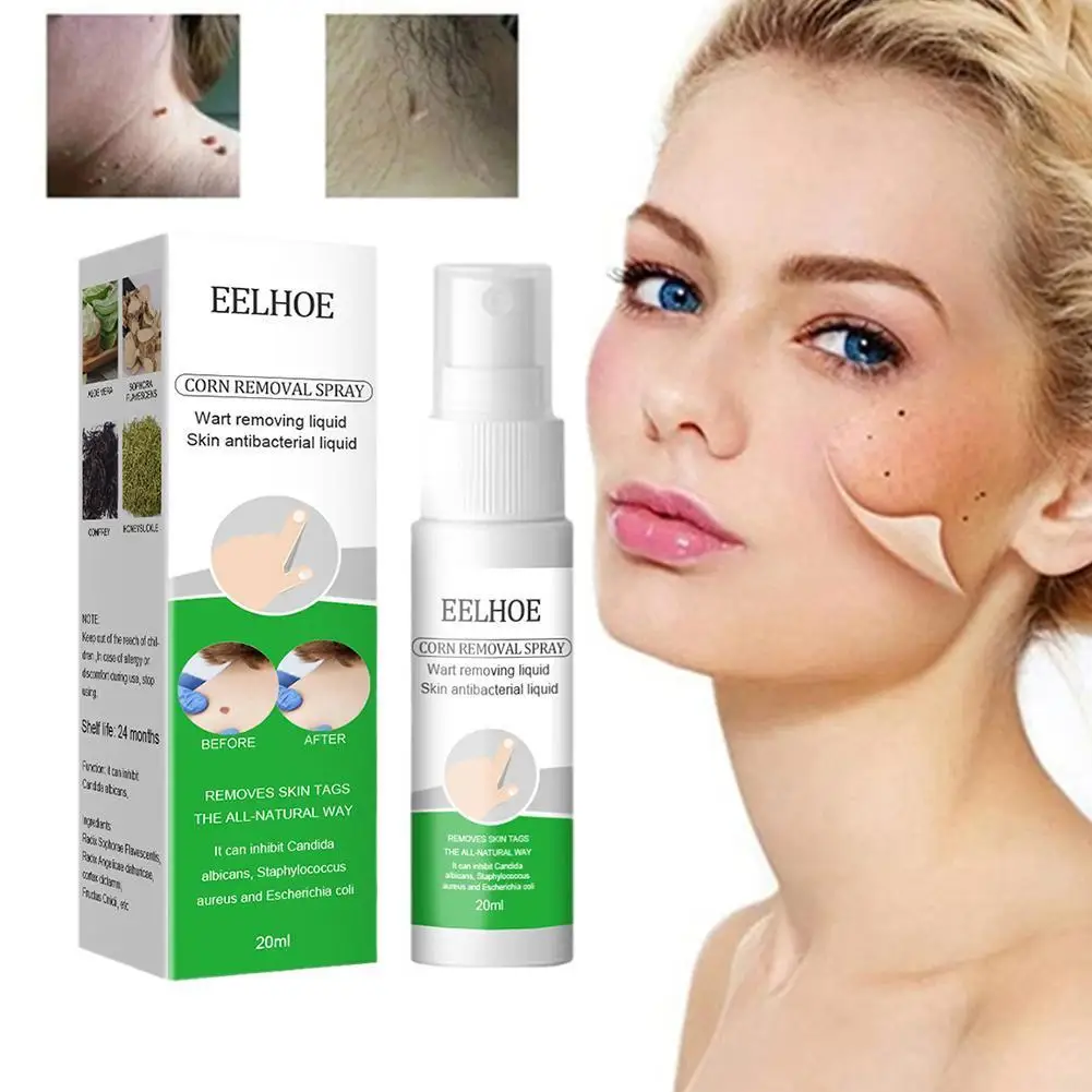 

20ml Wart Treatment Solution Foot Corn Removal Plantar Warts Liquid Body Black Dots Mole Wart Skin Tag Remover Plaster