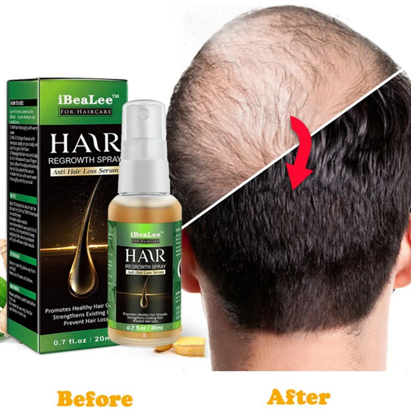 

Men Women Natural Hair Growth Products Essential Oils Hair Care Essence Spray Hair Loss Liquid Health Care Hair Growth SerumFor