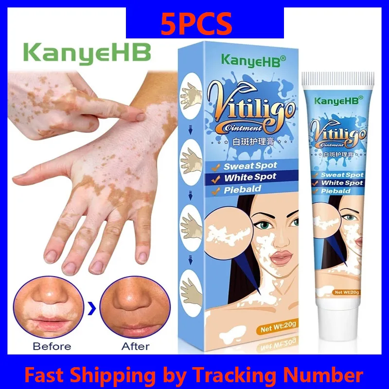 

5PCS Herbal Extract Vitiligo Ointment Remove Ringworm White Spot Removal Skin White Spot Leukoplakia Disease Treatment Cream