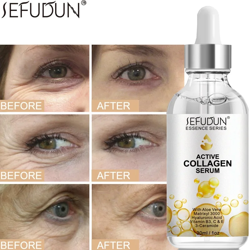

Sefudun Collagen Essence Moisturizes Wrinkles And Dark Circles Repairs Fine Lines Anti-Oxidation Face Serum Skin Care Firming