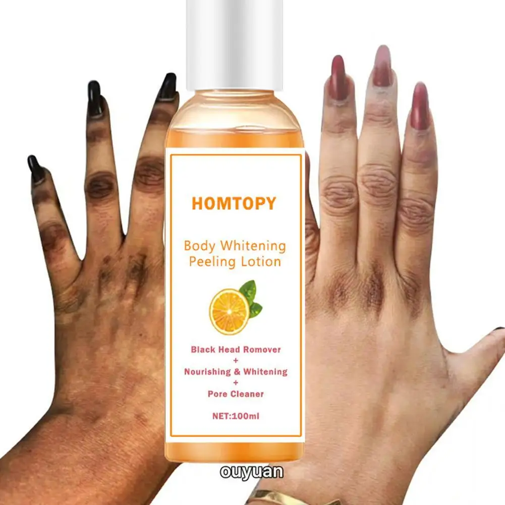 

Лосьон Для шелухи и отбеливания кожи, 100 мл