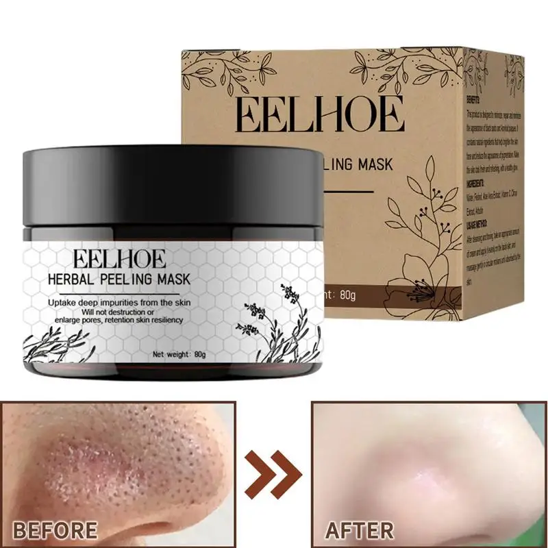 

Facial Peels Dead Skin Remover For Face Skin Peel Face Gently Pull Out Blackheads Moisturize Cleanse With Natural Herbal