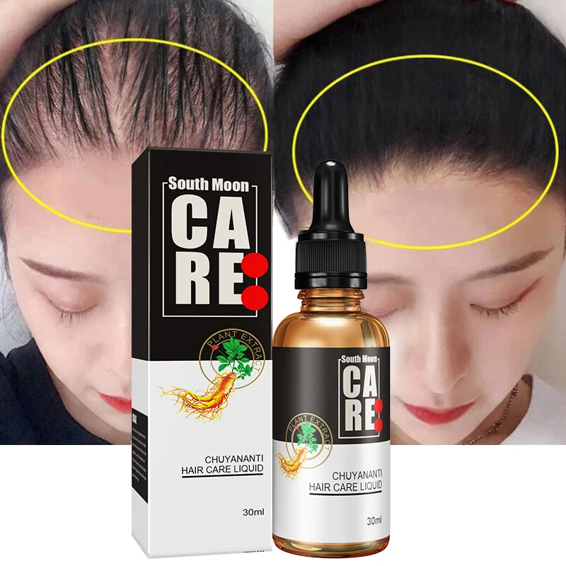 Oli essenziali per la crescita dei capelli Ginseng prodotti anticaduta per uomo donna trattamento rapido per la ricrescita dei capelli cura della salute di bellezza