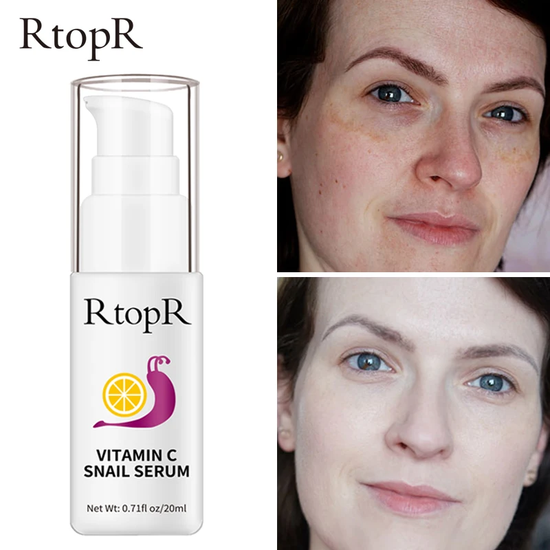 

Увлажняющая отбеливающая сыворотка с гиалуроновой кислотой, 20 мл