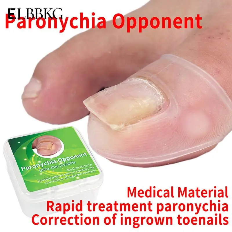 

2pcs/lot Ingrown Toenail Correction Tool Toe Cap Toenail Protector Big Toe Sleeves Thick Paronychia Correction Tool for Feet