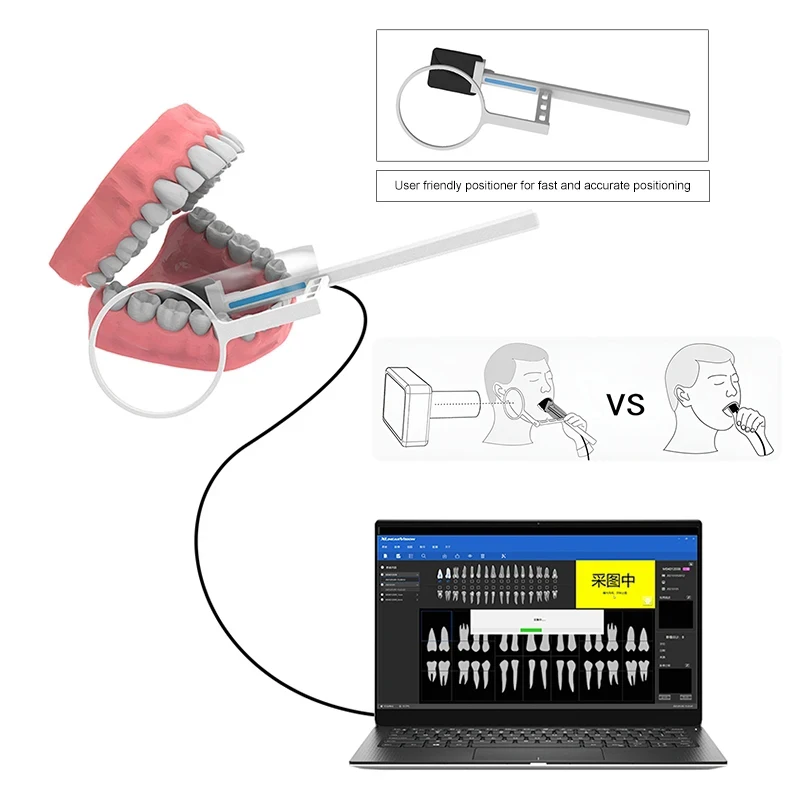 Фото Портативное стоматологическое оборудование rx Dental Xray Digital Sensor Imaging System radiovisografo Dental Intraoral raps x RVG Senor Dentist №5