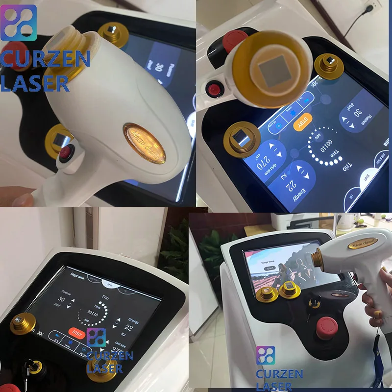 Диодный лазер для удаления волос нм |