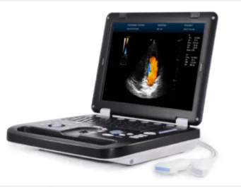 Рисунок 4 - Дешевый ноутбук, 3d-система Доплера,