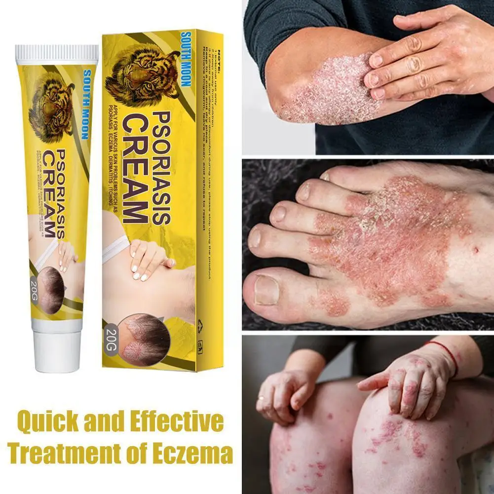 

Skin Moss Removal Cream Spot Smooth Skin Moisturizer Itching Skin Tightening Relaxing Cream Sweat Wrinkle Removal Relieve S H0Z0