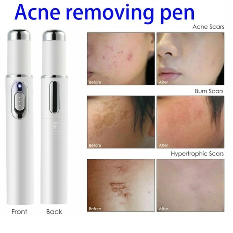 3 шт. лазерная ручка для лечения варикозного расширения вен |