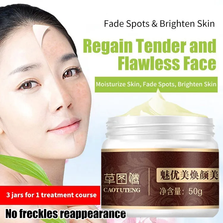 Freckles Cream Highly Recommended by 95% Japanese Dermatologist Traditional Chinese medicine spot removing cream for wome 50g