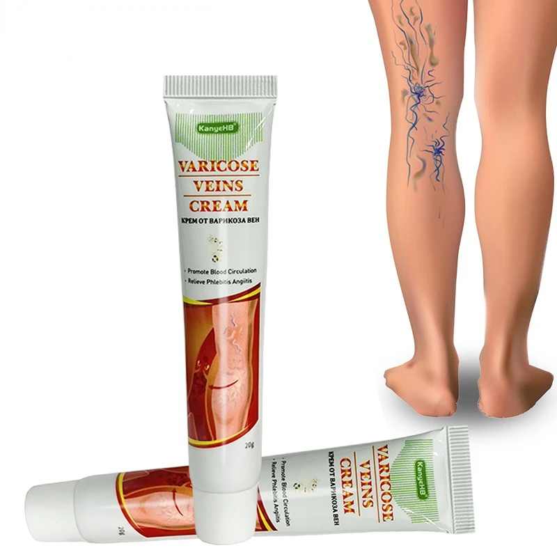 

1pcs Treatment For Varicose Veins Chinese Herbal Medicine Scrotum Varicosity Angiitis Removal Phlebitis Leg Veins Pain Ointment