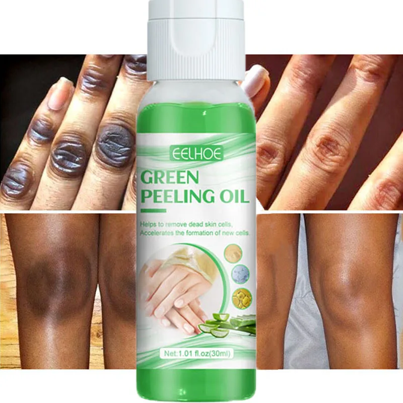 

Green Whitening Peeling Oil Underarm Bleaching Whiten Butt Knee Brighten Inner Thigh Dark Remove Melanin Moisturizing Skin Care