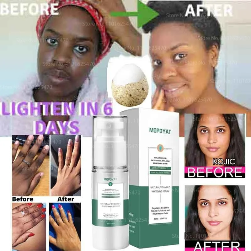 

Arbutin Skin Brightening Essence Liquid for Removing Chloasma Lightening Brightening Serum Kojic Acid Bleaching Cream Skin Care