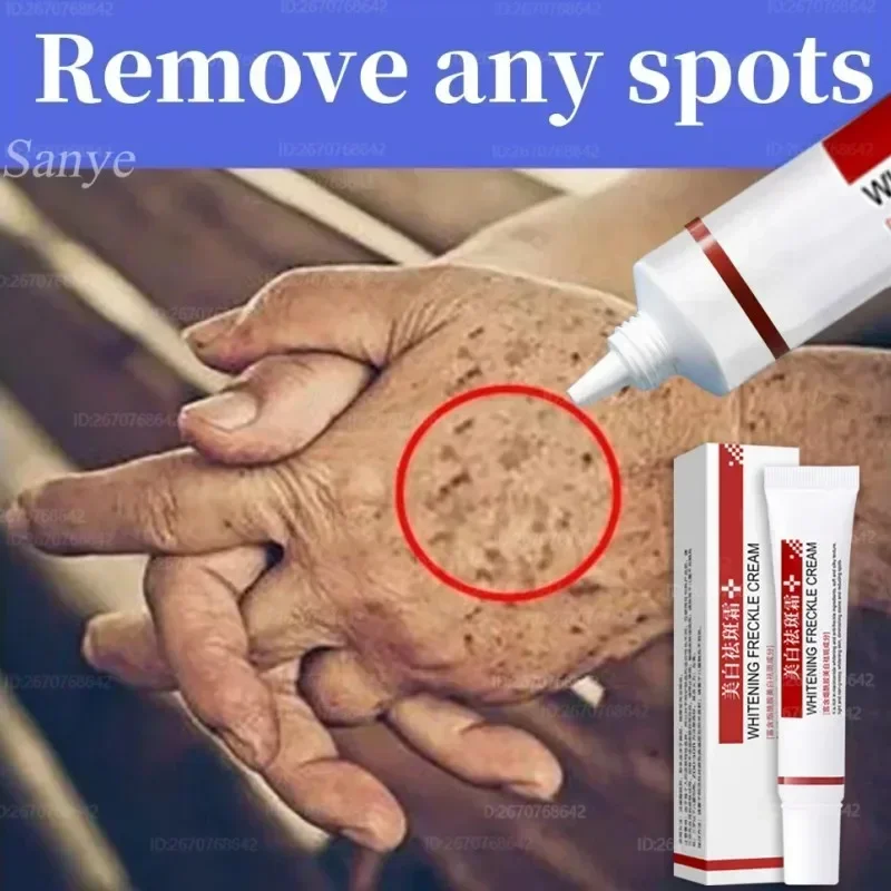Эффективный точечный крем быстрое отбеливание удаление мелазмы на лице мелазма