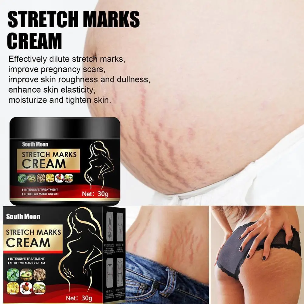 

Stretch Marks Removal Cream Maternity Scar Removal Cream Whitening Pregnancy Obesity Breast Repair Buttocks Skin T3r4
