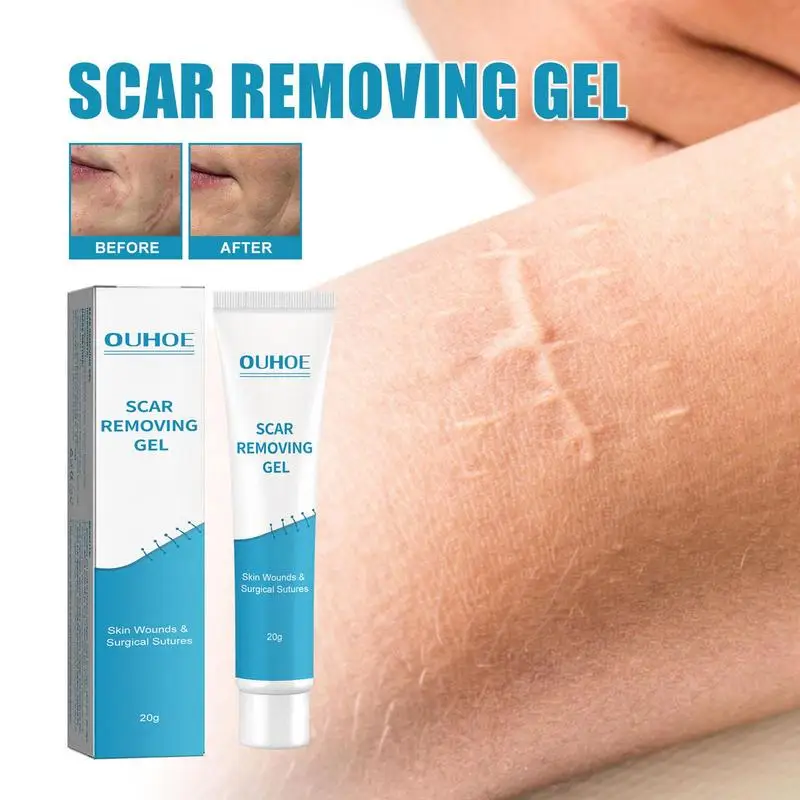 

20g Scar Removal Gel Stretch Marks Removal Scars Skin Repair Moisturizing Gel Softens Smoothen Scar Cream Face Body Skin Care