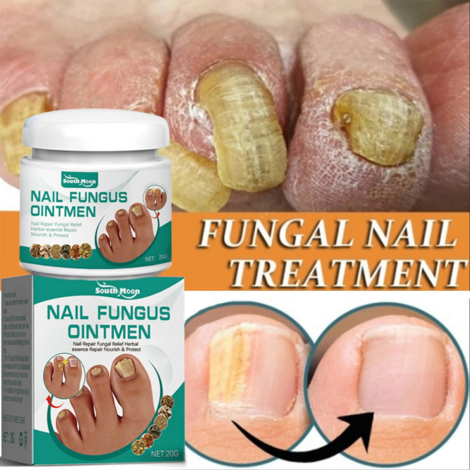 Nail Fungus Treatment Essence Cream Anti Fungal Foot Toe Repair Gel Anti-Infection Onychomycosis Paronychia Remove Care Ointment