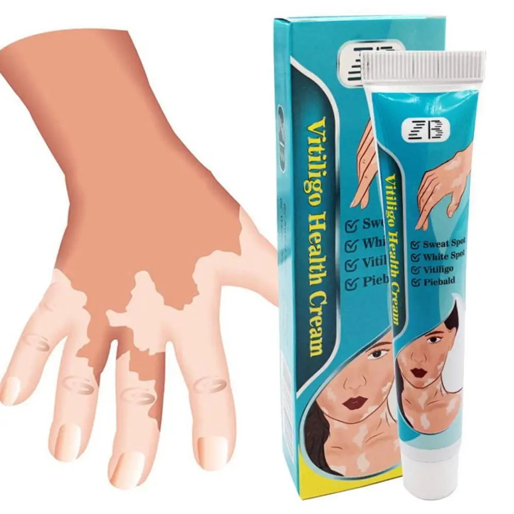 

20g Vitiligo Treatment Cream White Spot Psoriasis Cream Antibacterial Localized Vitiligo Cream Mycosis Leukoplakia Health Care
