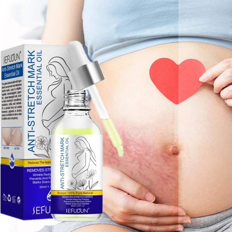 

Stretch Mark Remover Essential Oil Skin Care Treatment Cream Repair Maternity Sagging Line Body Skin Care Essential Oil