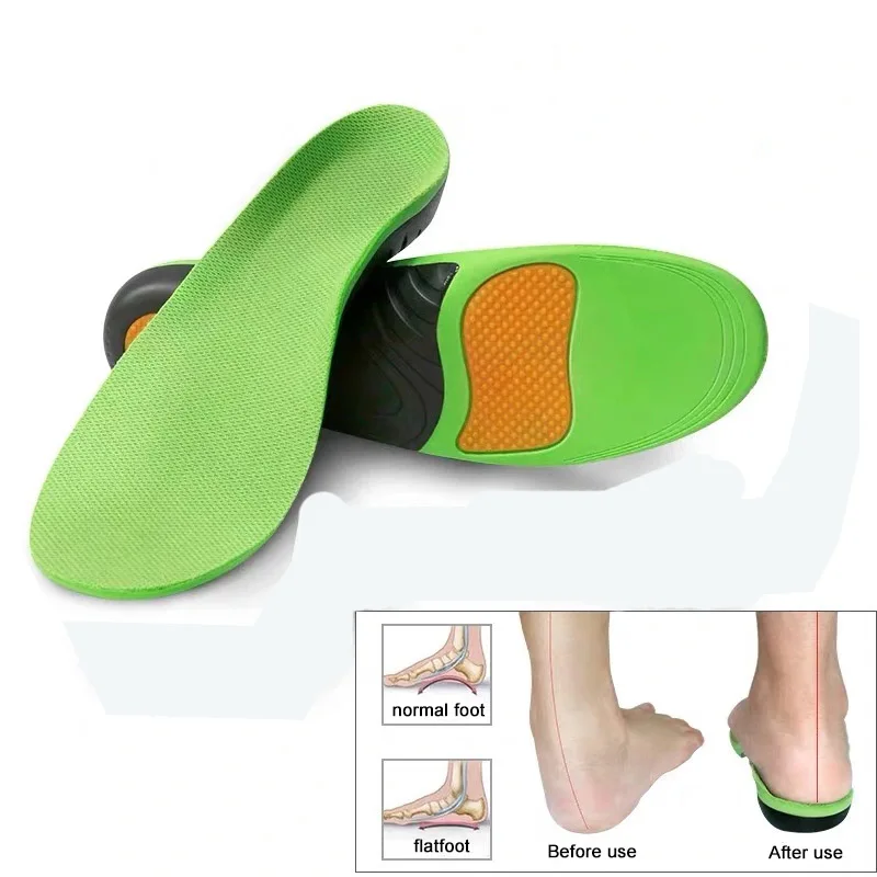 Best EVA Orthopedic Shoes Sole Insole X/O Leg Arch Foot Pad Corrective Flat Arch Support Sports Insole