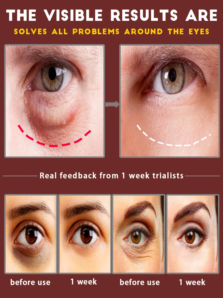 Проблемы для решения вокруг области глаз