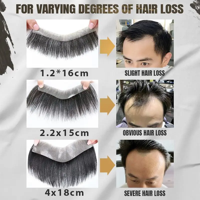 

Men’s Hairline Toupee Wig V Loop Front Hairline Forehead Toupee for Men Wigs Hair Replacement Frontal Hairpeices Hide Hairline
