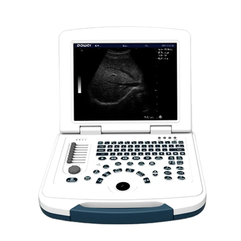 

DW 580 Black And White Full Digital Ultrasound Medical Hospital Diagnosis Equipment Portable Laptop Ultrasound Equipment