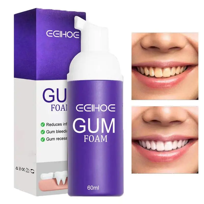 

Purple Toothpaste For Teeth 60ml Teeth Mousse Foam Toothpaste For Travel Refreshing Breath Brightens Teeth Against Yellow Teeth